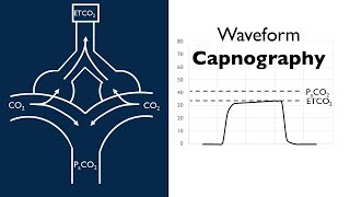 Waveform Capnography  BAVLS [upl. by Mathian]