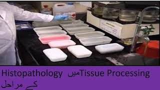 tissue processing in histopathology lab [upl. by Itoc]