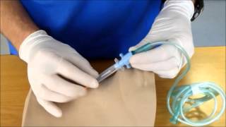 Needle Cricothyroidotomy [upl. by Rennane]