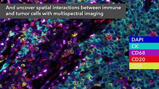 PerkinElmer Better understand complex interactions in the tumor microenvironment [upl. by Stav202]