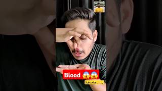 Blood magic ❗️ 😱😨 ‼️ youtubeshortsshorts magic magician viral ytshorts fun [upl. by Shu]