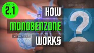 Ep 21 How Monobenzone Works [upl. by Tillman]