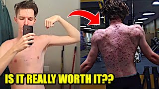 A 20yr Old Idiot Takes Steroids amp This Happens [upl. by Sirehc]