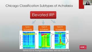 Update on pathophysiology and work up for Achalasia [upl. by Eadith]