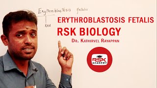 ERYTHROBLASTOSIS FETALIS NEET CONCEPTS  NEET SHORTCUTS  RSK ACADEMY [upl. by Morissa]