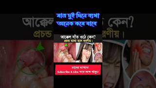 আক্কেল দাঁত ব্যথা হলে করণীয়💯shorts shortvideo trendingshorts akkel dat betha komanor upay [upl. by Malca]