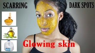 DIY Tumeric face mask [upl. by Otaner]