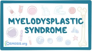 Myelodysplastic syndromes  causes symptoms diagnosis treatment pathology [upl. by Sirret62]