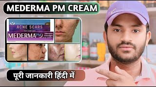 Mederma pm cream uses dose benefits and Side effects full review in hindi [upl. by Atnima]