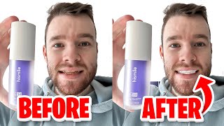 HiSmile v34 Colour Corrector  Get White Teeth Easy  Honest Review [upl. by Yrrak]