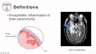 2 Bacterial Meningitis Pathogenesis and Clinical Manifestion [upl. by Nnalorac322]