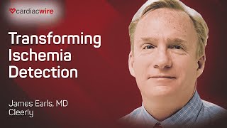 The Cardiac Wire Show – Transforming Ischemia Detection [upl. by Beker]