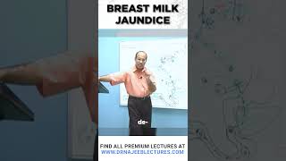 Breast Milk Jaundice drnajeeb jaundice shortvideo [upl. by Kriste]