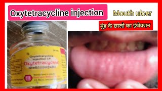 Oxytoxin injection l mouth ulcer l मुंह के छालो का इंजेक्शन l Oxytetracycline injection use in hindi [upl. by Idolla]