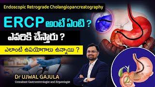 What is ERCP telugu  ERCP endoscopic retrograde cholangiopancreatography Procedure  Dr Ujwal [upl. by Cormac]