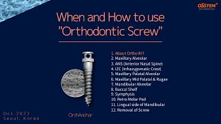 1 About Ortho KIT When and How to use quotOrthodontic Screwquot [upl. by Cicero]