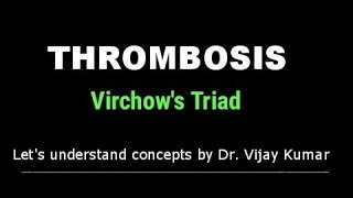 Thrombosis Pathology  Virchows Triad  Thrombus Formation  Pathology Lectures [upl. by Varick]