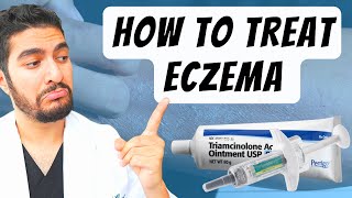 How To Treat Eczema Dermatologist Explains [upl. by Delilah]