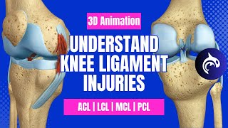 Understand Knee Ligament Injuries ACL PCL MCL LCL  3D animation [upl. by Leifer934]