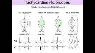 ECG indispensables en SAMU et urgence Partie 3 Tachycardies Dr Taboulet [upl. by Nayb]