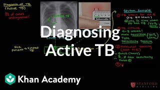 Diagnosing active TB  Infectious diseases  NCLEXRN  Khan Academy [upl. by Switzer]