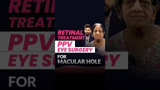 Eye Surgery for Macular Hole in Retina [upl. by Pierson]