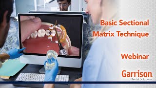 Basic Sectional Matrix Technique [upl. by Adnuahsar]