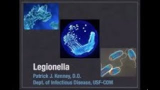 Legionella  Patrick Kenney MD [upl. by Abie]