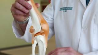 What is Runner’s Knee  Pain in knee when walking  Runners Knee Pain [upl. by Siver67]