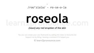 Pronunciation of Roseola  Definition of Roseola [upl. by Theodore]