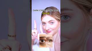 how to remove dark circles and eye bags darkcircles eyebags facemassage faceyoga faceexercise [upl. by Yahsal]