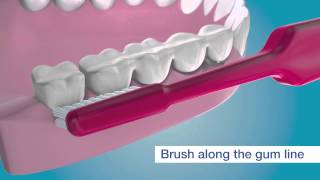 The Implant Orthodontic Brush by TePe [upl. by Dikmen]