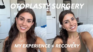 Otoplasty Surgery My experience before  after healing  recovery [upl. by Dnalyar]