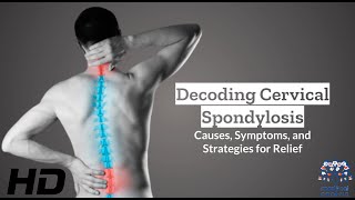 Cervical Spondylosis 101 Causes Symptoms and Treatment Insights [upl. by Neelav82]