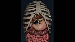 Ascites in liver cirrhosis 😱 [upl. by Ringsmuth]