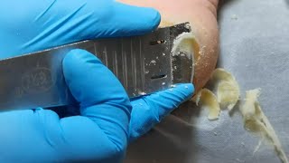 Pedicure  Sliced cheese Dead skin removal and Cracked heels treatment Callus removal from feet [upl. by Eelatan424]