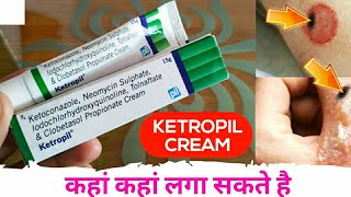 Ketoconazole Neomycin Iodochlorhydroxyquinoline Tolnaftate amp Clobetasol Propionate Cream Ketropil [upl. by Eittocs206]