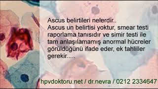 ASCUS nedir ASCUS Tanı ve Tedavisi ASCUS HPV 16 18 ASCUS Kolposkopi Sonuçları [upl. by Bright1]