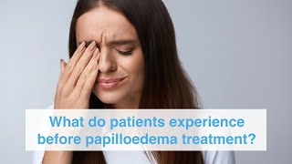 What do patients experience before papilloedema treatment [upl. by Nylkaj]