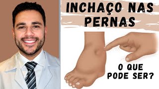 Inchaço nas pernas Saiba o que pode ser  Cardiologista  Dr Caio Henrique [upl. by Stochmal476]