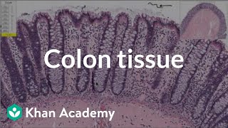 Normal colon tissue  Gastrointestinal system diseases  Health amp Medicine  Khan Academy [upl. by Darrell]