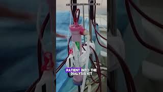 How Hemodialysis Filters Blood  Quick Overviewhemodialysis kidneydialysis dialysistreatment [upl. by Ahsiruam]