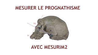 Mesurer langle facial prognathisme dans Mesurim2 [upl. by Yevi]