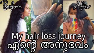 How I am trying to grow back my hair WITHOUT any treatments  Live results Asvi Malayalam [upl. by Euhsoj958]