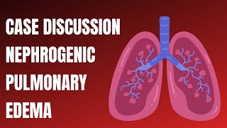 Case Discussion  Nephrogenic Pulmonary Edema [upl. by Ronn83]