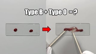 What Happens When Two Different Blood Types are Mixed Together [upl. by Arlon]