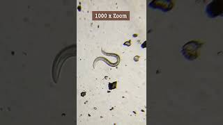 LOOK what I found in Soil🤯CloseUp of Nematodes under the Microscope shorts nematode microbiology [upl. by Gaige]