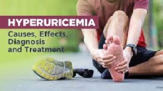 hyperuricemia and its Treatment Gout hyperuricaemia treatment drbadarkhan kneeepain jonpain [upl. by Lleneg]