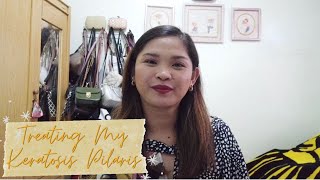 VLOG 21 Treating my Keratosis Pilaris [upl. by Blossom430]