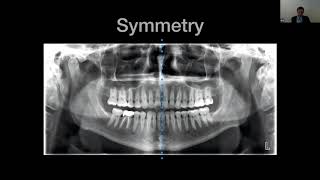 CBCT Interpretation Crash Course for the New User with Dr Peter Green [upl. by Guillaume888]